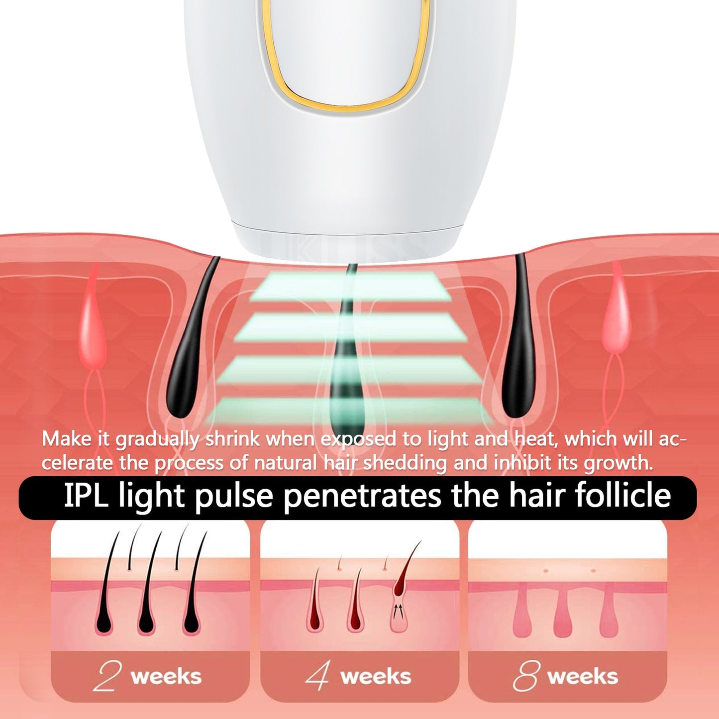 Electric Laser Epilator For Women
