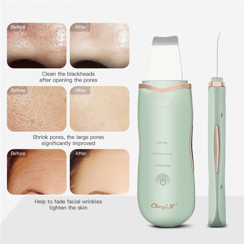 Ultrasonic Deep Face Cleaning Machine