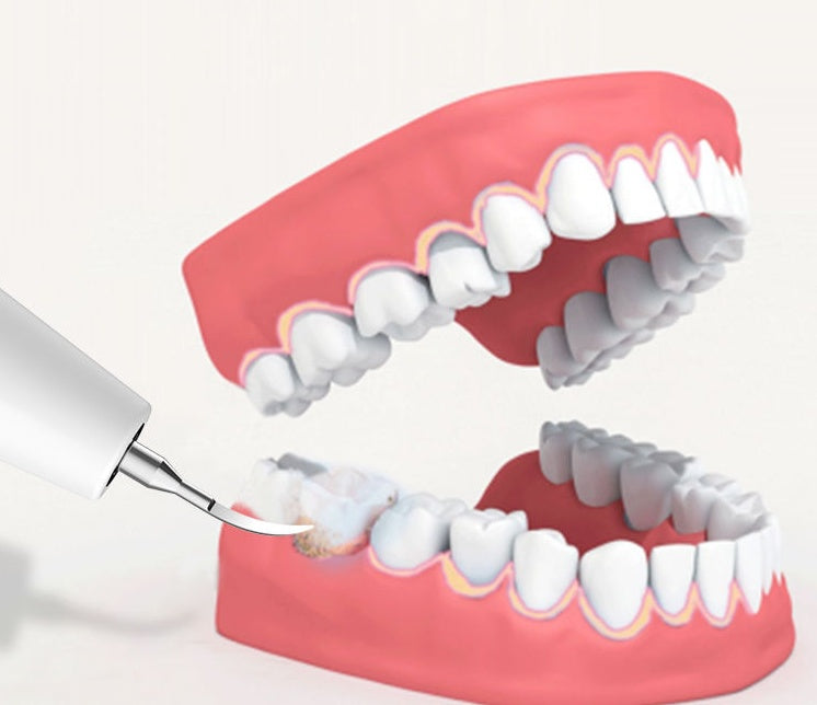 New Ultrasonic Household Dental Calculus Removal