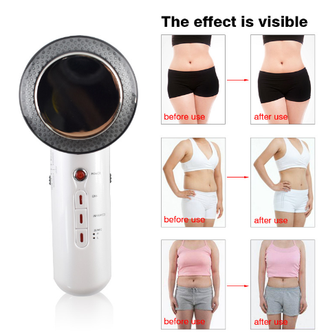 Beauty Care Slimming Device Handheld Fat Remove