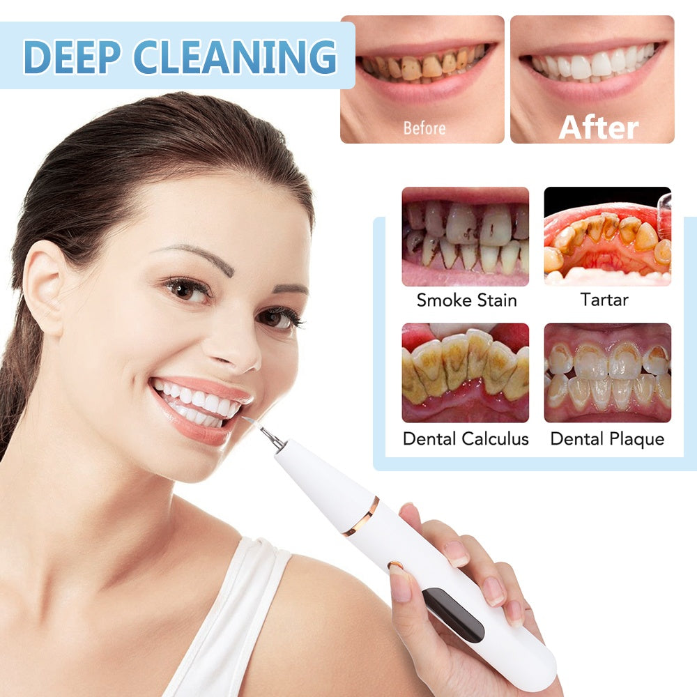 New Ultrasonic Household Dental Calculus Removal